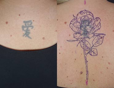 Kanji Cover Up vorher