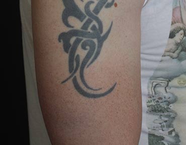 Tribal Cover Up vorher